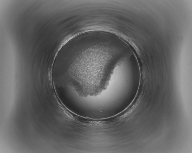 X0000115851529200911201603