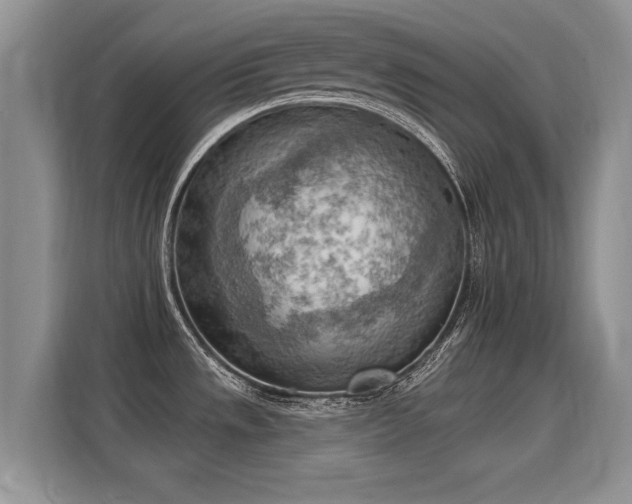 X0000115851533200911201603