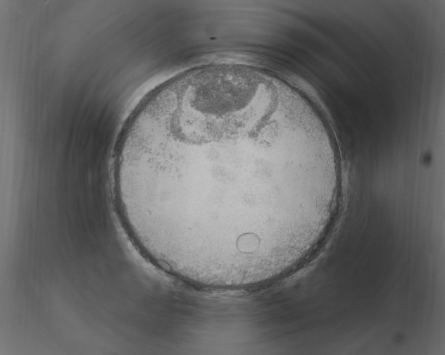 X0000115851133200912242032
