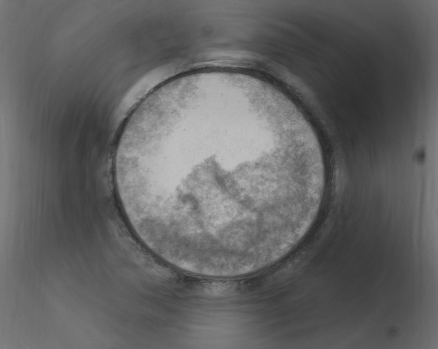 X0000115851362200912242029