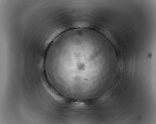 X0000116000159200911191432