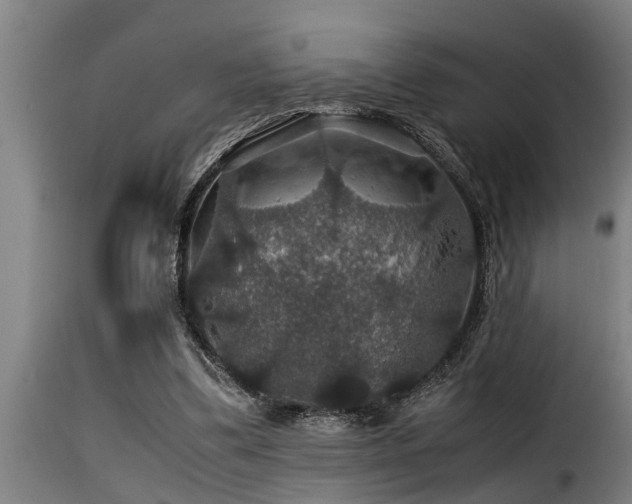 X0000116000299200911191430