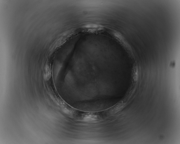 X0000116000471200911191428