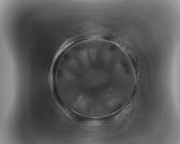 X0000116000198200911251107