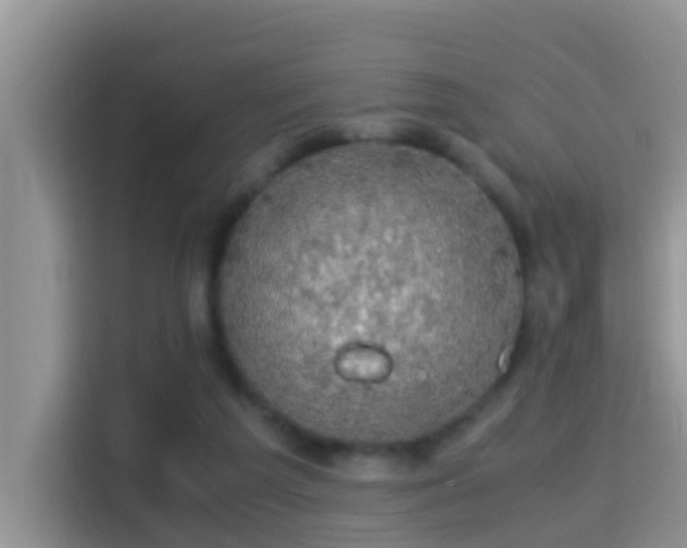 X0000116000209200911251107