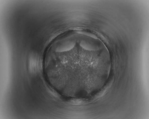 X0000116000299200911251106