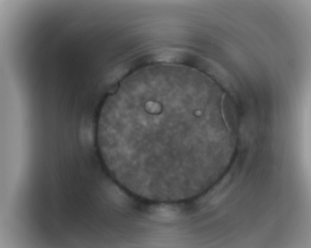 X0000116000305200911251106