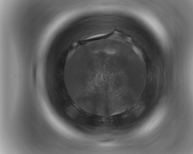 X0000116000383200911251105