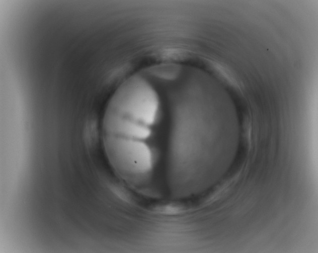 X0000116000506200911251103