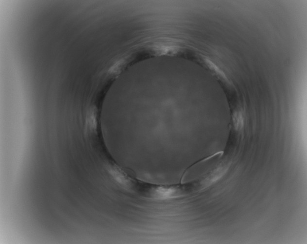 X0000116000570200911251103