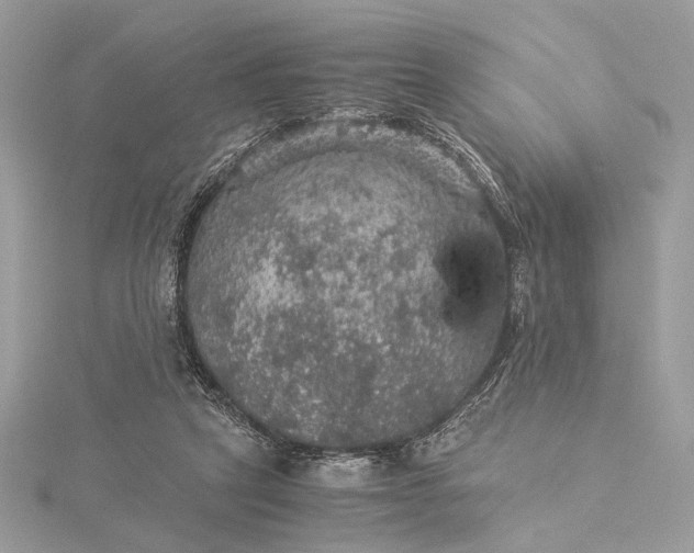 X0000116000257200912031515