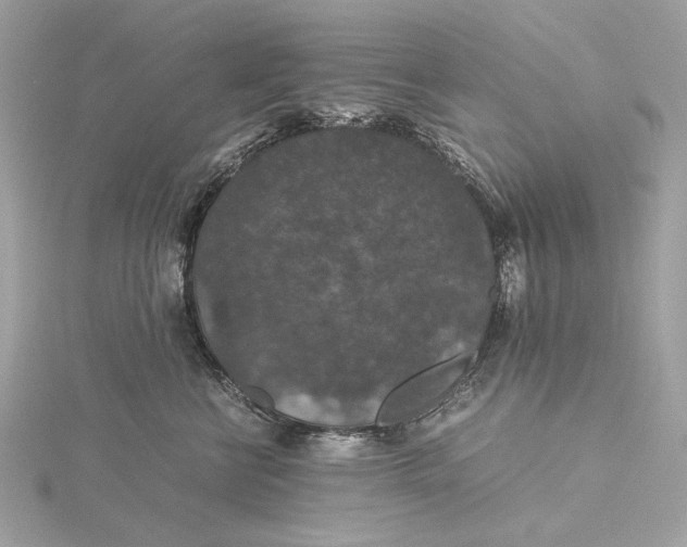 X0000116000570200912031511