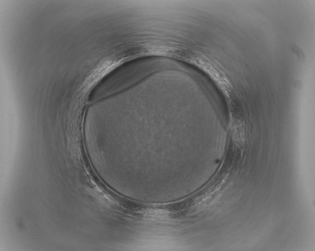 X0000116000577200912031511