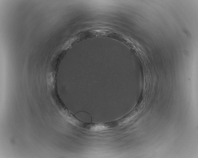 X0000116010759200911191525