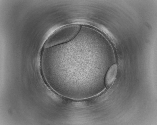 X0000116011376200911191516