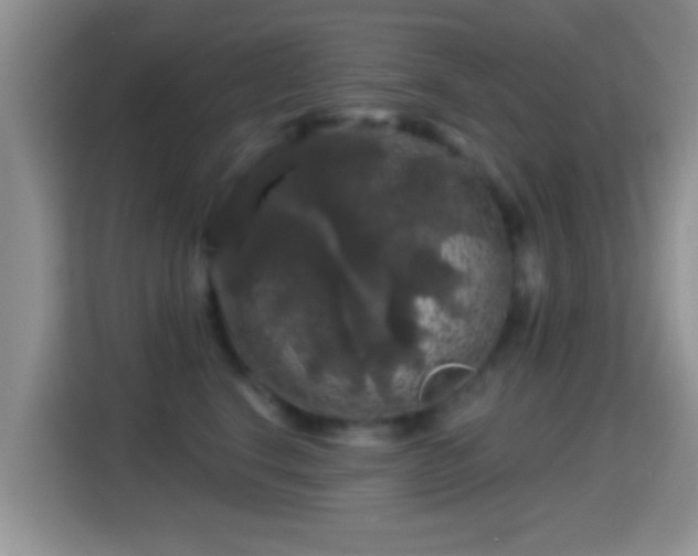 X0000116010664200911251121