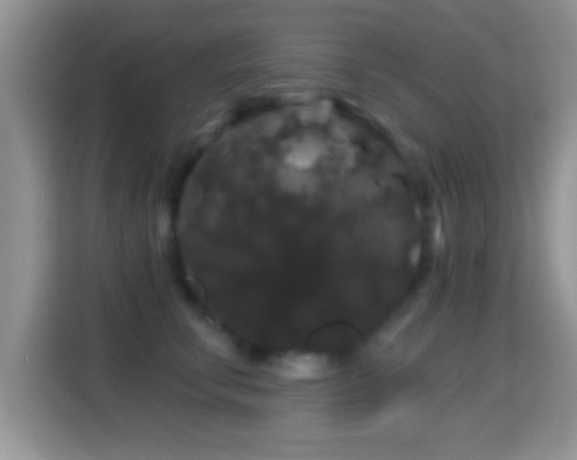 X0000116010711200911251120