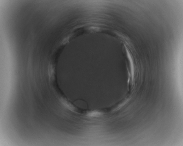 X0000116010759200911251120