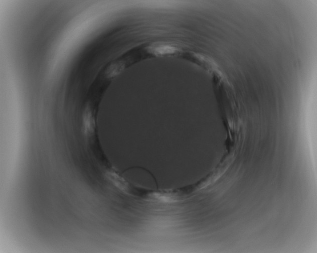 X0000116010763200911251120