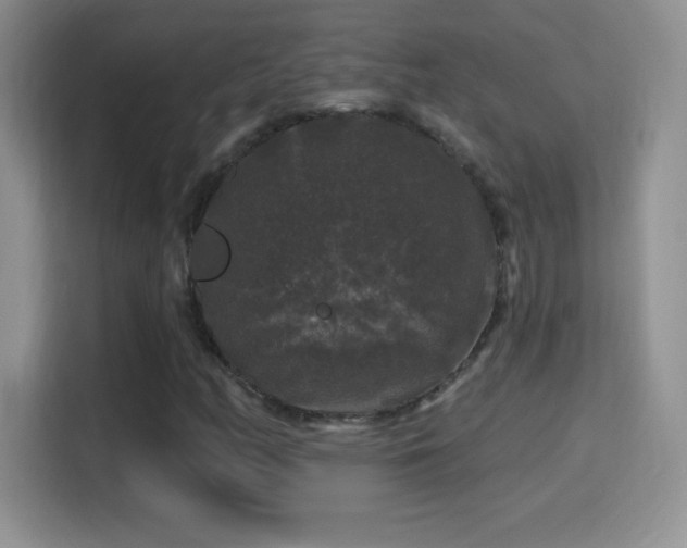 X0000116011158200911251115