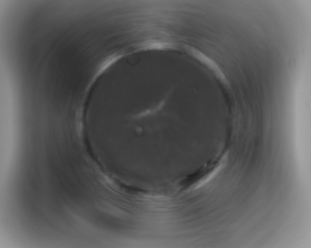 X0000116011170200911251115