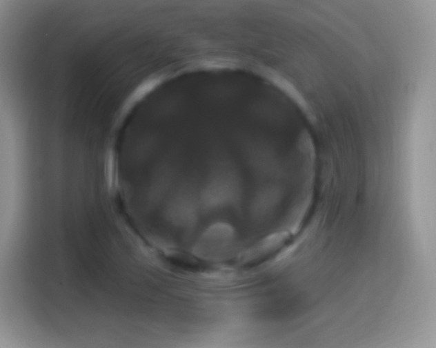 X0000116011171200911251115