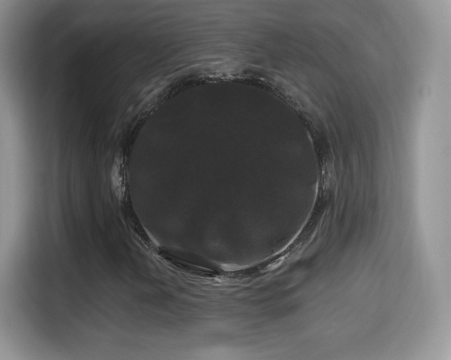 X0000116011202200911251113