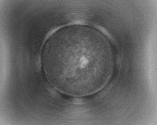 X0000116011364200911251112