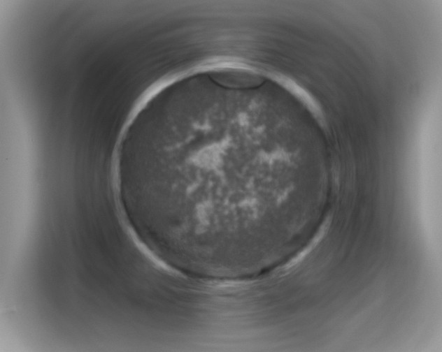 X0000116011382200911251112