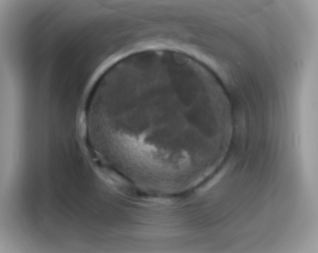 X0000116011509200911251110