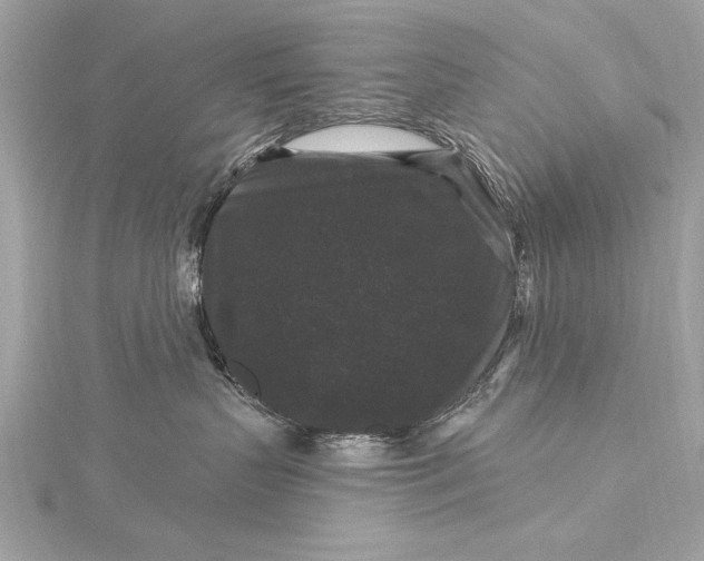 X0000116010383200912031535