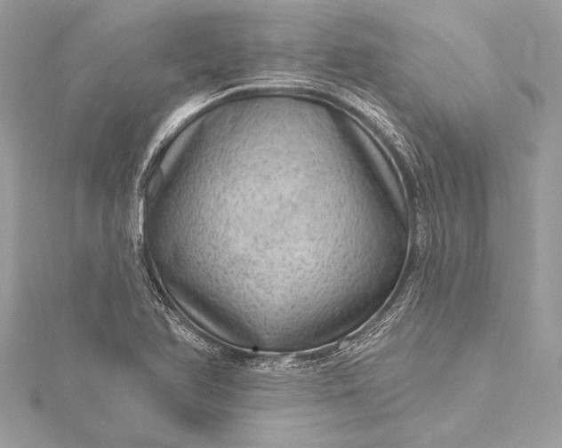 X0000116011366200912031521