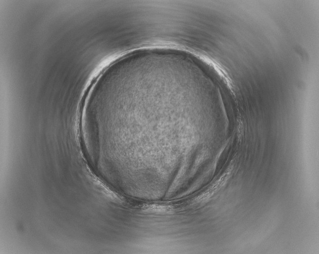 X0000116011374200912031521