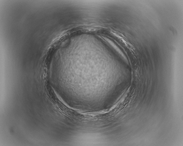 X0000116011447200912031520