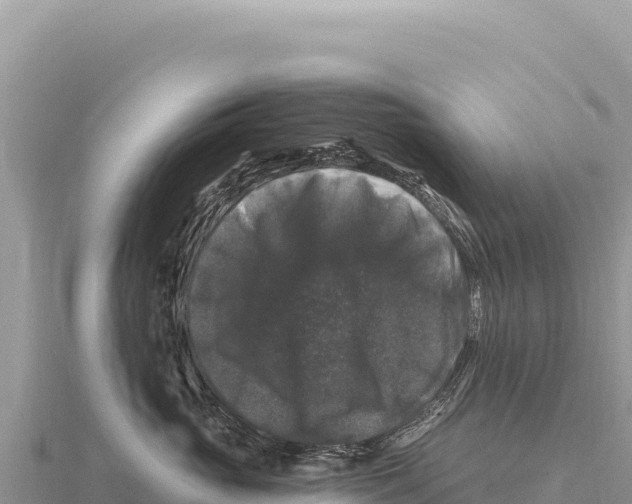X0000116010765200912171011