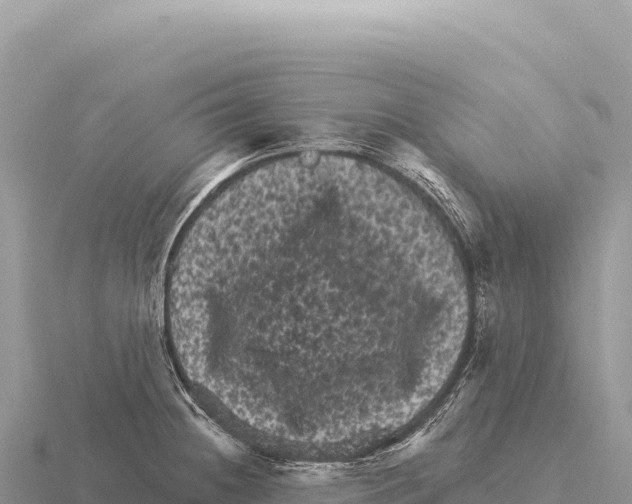 X0000116011236200912171004