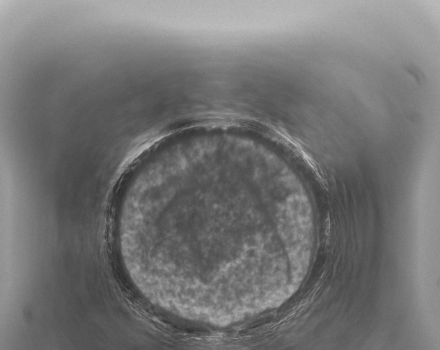 X0000116011352200912171002