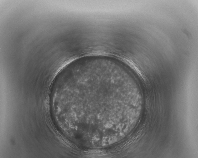 X0000116011356200912171002