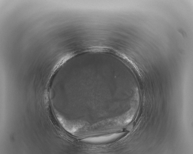 X0000116011362200912171002