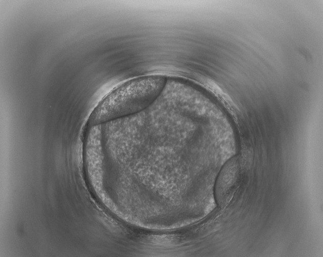 X0000116011376200912171002