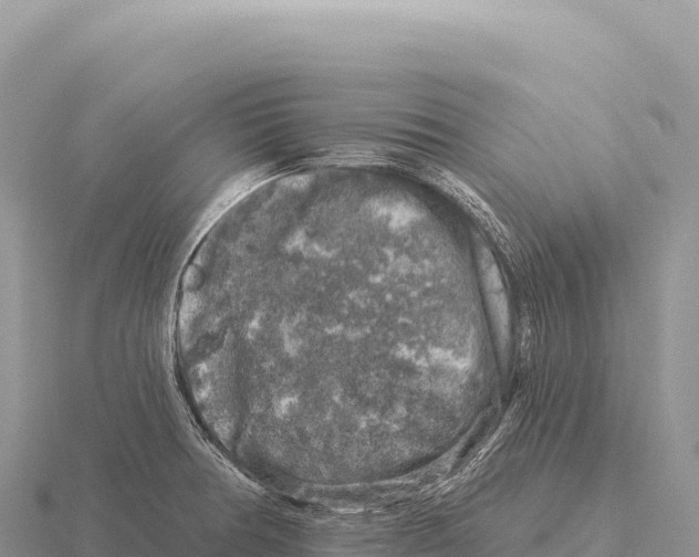 X0000116011378200912171002