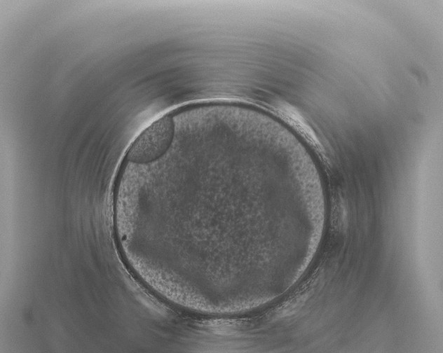 X0000116011380200912171002