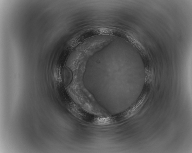 X0000116020189200911271123