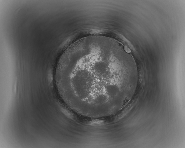 X0000116020257200911271122