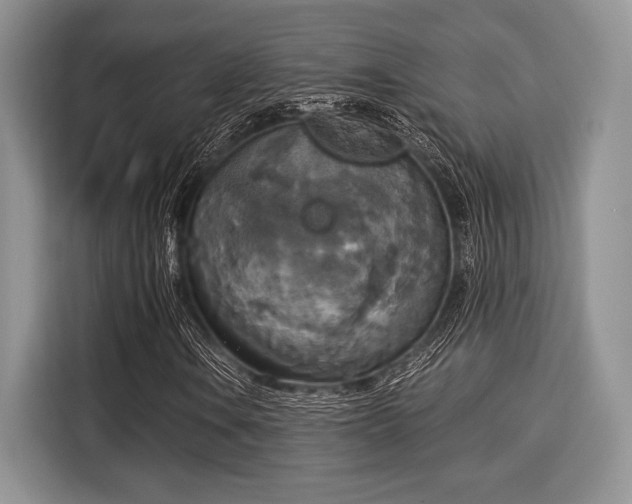 X0000116021106200911271110