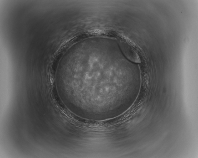 X0000116021206200911271109