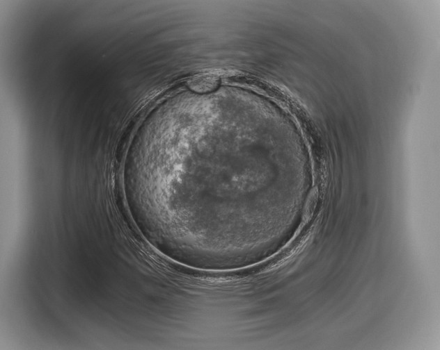 X0000116021257200911271109