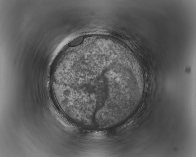 X0000116020056200912111402