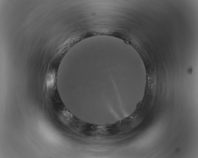 X0000116020143200912111401