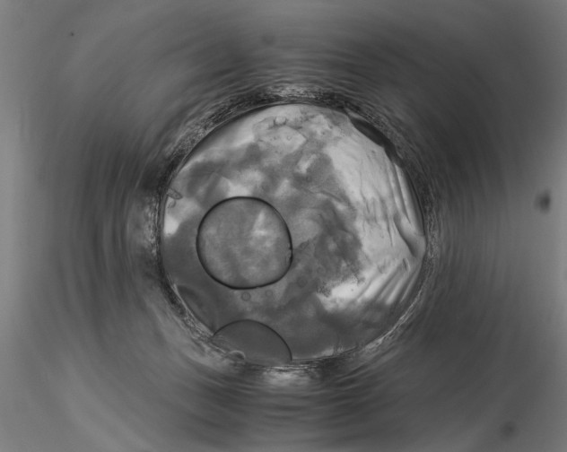 X0000116020175200912111400